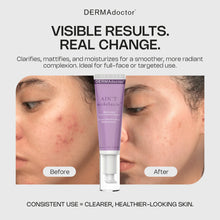 Load image into Gallery viewer, Ain't Misbehavin' Medicated Acne Control Serum