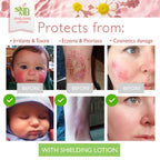 Skin MD Shielding Lotion | 8oz