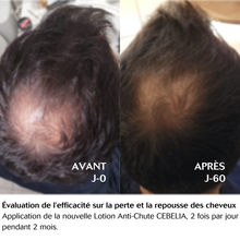 Load image into Gallery viewer, Anti-Hair Loss Lotion Scalp | 60ml
