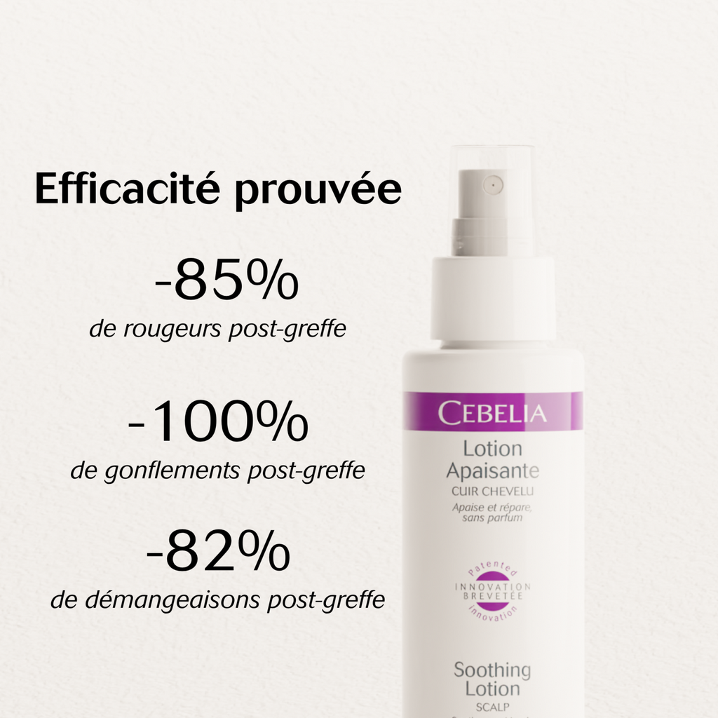 Soothing Lotion Scalp | 60ml